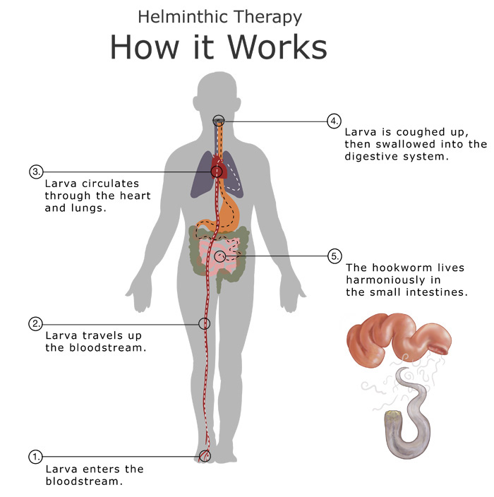 hookworms in humans symptoms